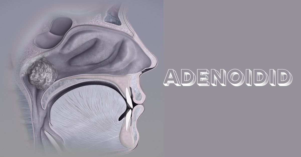 adenoidid